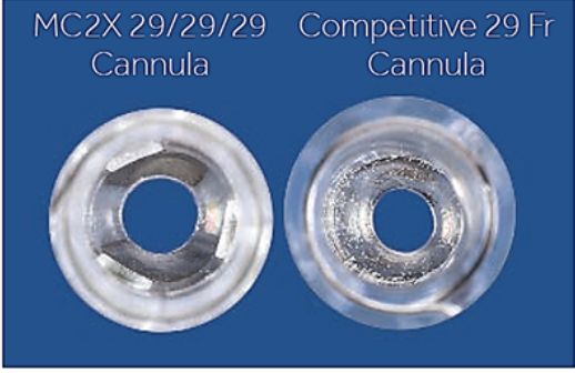 MC2X